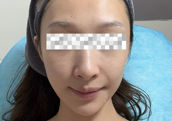 Before